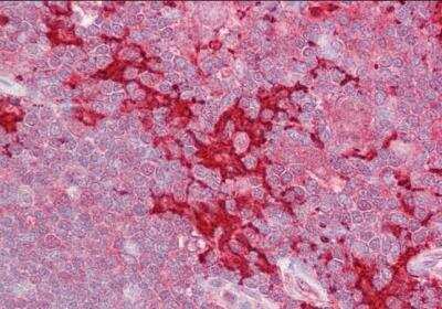 Immunohistochemistry-Paraffin: MAP4K1 Antibody [NB100-1045]