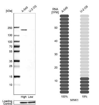 Western Blot: MAP4K6 Antibody [NBP2-49220]