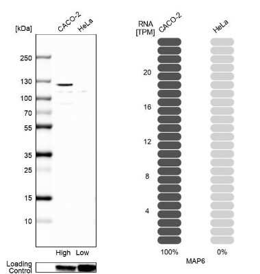 Western Blot: MAP6 Antibody [NBP2-14220]