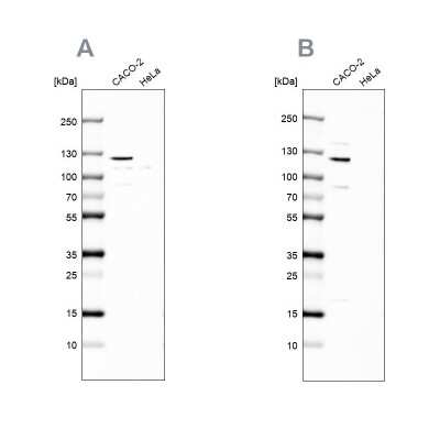 Western Blot: MAP6 Antibody [NBP2-14220]