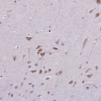 Immunohistochemistry-Paraffin: MAP7D2 Antibody [NBP2-14740]