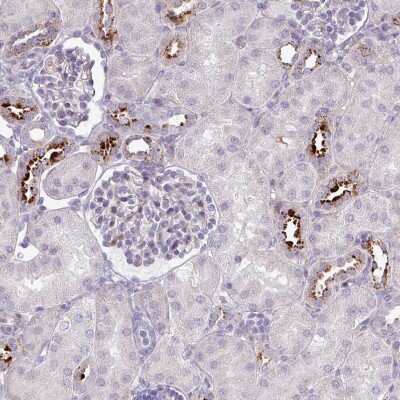 Immunohistochemistry-Paraffin: MAP7D2 Antibody [NBP2-14740]