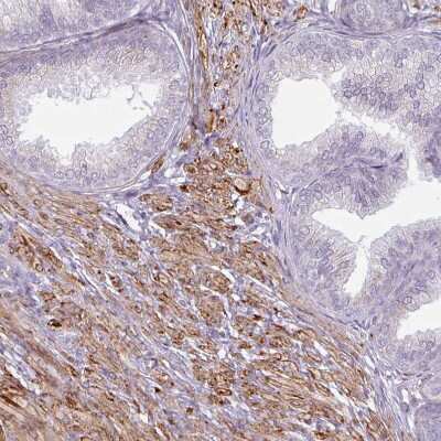 Immunohistochemistry-Paraffin: MAP7D2 Antibody [NBP2-14740]