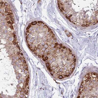 Immunohistochemistry-Paraffin: MAP7D2 Antibody [NBP2-14740]