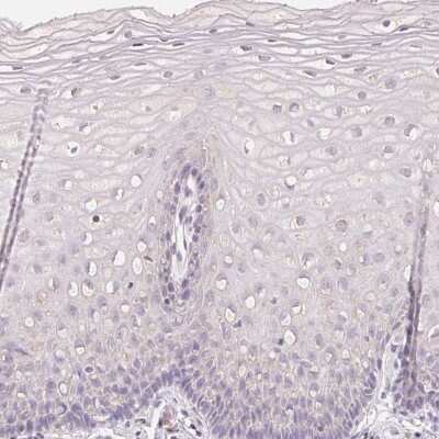 Immunohistochemistry-Paraffin: MAP7D2 Antibody [NBP2-49300]