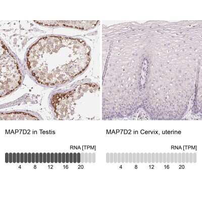 Immunohistochemistry-Paraffin: MAP7D2 Antibody [NBP2-49300]