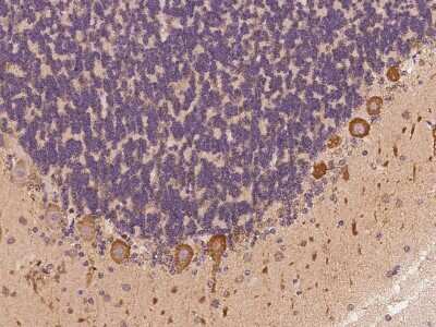 Immunohistochemistry-Paraffin: MAP7D2 Antibody [NBP2-97908]