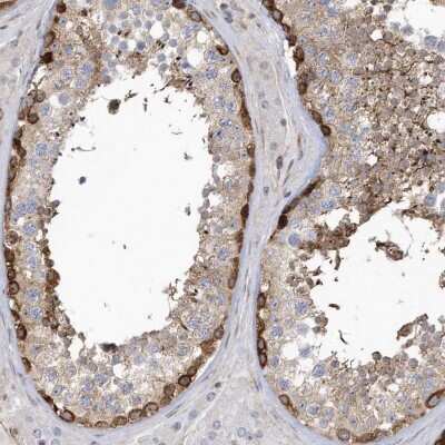 Immunohistochemistry-Paraffin: MAP7D3 Antibody [NBP1-94030]