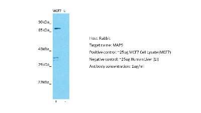 Western Blot: MAP9 Antibody [NBP2-83182]