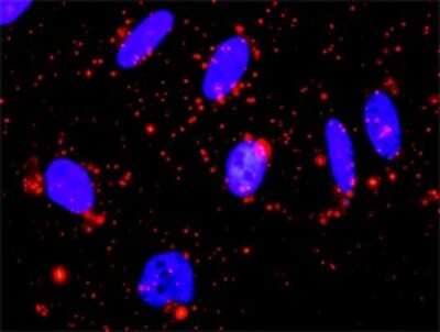 Proximity Ligation Assay: MAPKAP Kinase 3 Antibody (2B5) [H00007867-M02]