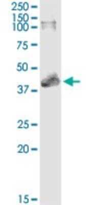 Immunoprecipitation: MAPKAP Kinase 3 Antibody (3F4) [H00007867-M01]