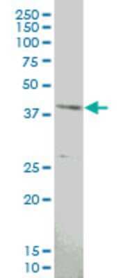 Western Blot: MAPKAP Kinase 3 Antibody (4B11) [H00007867-M06]