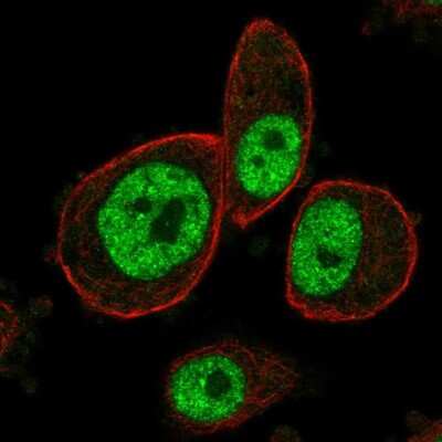 Immunocytochemistry/ Immunofluorescence: MAPKAP Kinase 3 Antibody [NBP2-58080]