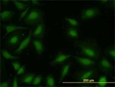 Immunocytochemistry/ Immunofluorescence: MAPKAPK2 Antibody (2B3) [H00009261-M01]