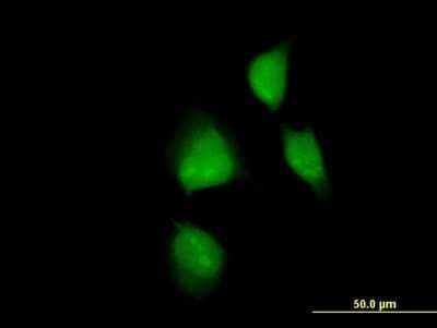Immunocytochemistry/ Immunofluorescence: MAPKAPK2 Antibody (3A7) [H00009261-M10]