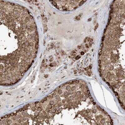 Immunohistochemistry: MAPKBP1 Antibody [NBP2-38164]