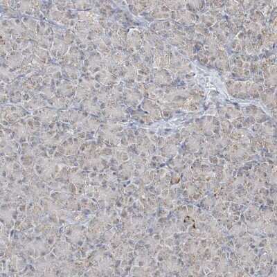 Immunohistochemistry-Paraffin: MAPKBP1 Antibody [NBP2-38164]