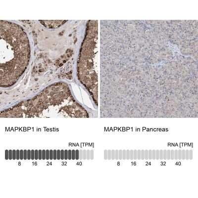 Immunohistochemistry-Paraffin: MAPKBP1 Antibody [NBP2-38164]