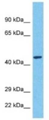 Western Blot: MARCH11 Antibody [NBP3-10571]