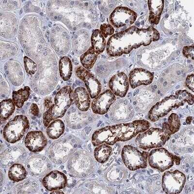 Immunohistochemistry-Paraffin: MARCH3 Antibody [NBP1-81260]