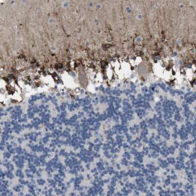 Immunohistochemistry-Paraffin: MARCH8 Antibody [NBP1-85540]