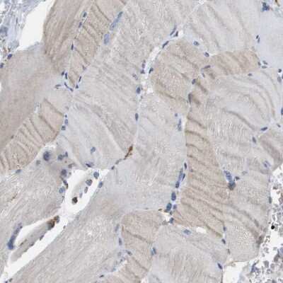 Immunohistochemistry-Paraffin: MARCH8 Antibody [NBP1-85540]