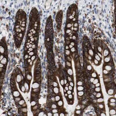 Immunohistochemistry-Paraffin: MARCH8 Antibody [NBP1-85540]