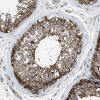 Immunohistochemistry-Paraffin: MARCH8 Antibody [NBP1-85540]