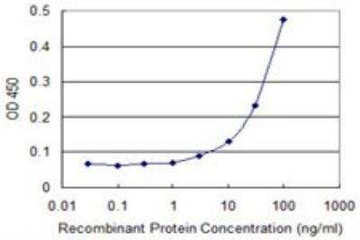 ELISA: MARCH9 Antibody (2B5) [H00092979-M01]