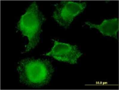 Immunocytochemistry/ Immunofluorescence: MARCH9 Antibody (2B5) [H00092979-M01]