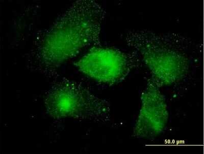 Immunocytochemistry/ Immunofluorescence: MARCKS Antibody (2C2) [H00004082-M06]
