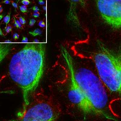 Immunocytochemistry/ Immunofluorescence: MARCKS Antibody [NBP3-05539]