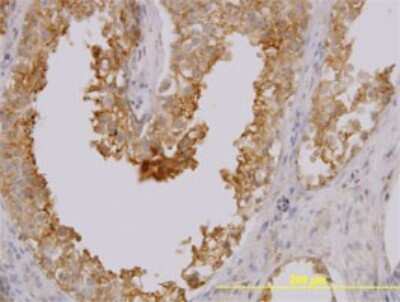 Immunohistochemistry-Paraffin: MARCKS like protein Antibody (8C8) [H00065108-M02]