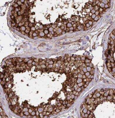 Immunohistochemistry-Paraffin: MARCKS like protein Antibody [NBP2-38160]
