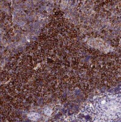 Immunohistochemistry-Paraffin: MARCKS like protein Antibody [NBP2-38160]