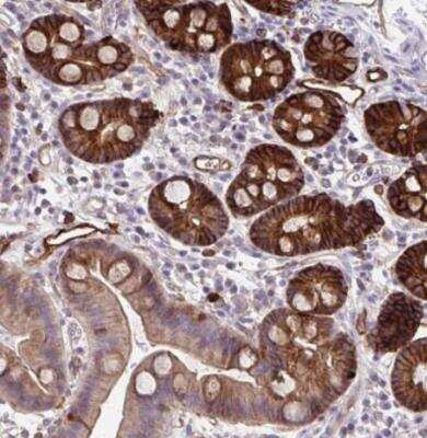 Immunohistochemistry-Paraffin: MARCKS like protein Antibody [NBP2-38160]