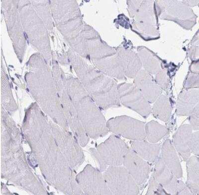 Immunohistochemistry-Paraffin: MARCKS like protein Antibody [NBP2-38160]