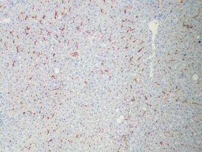 Immunohistochemistry: MARCO Antibody [NBP2-39004]
