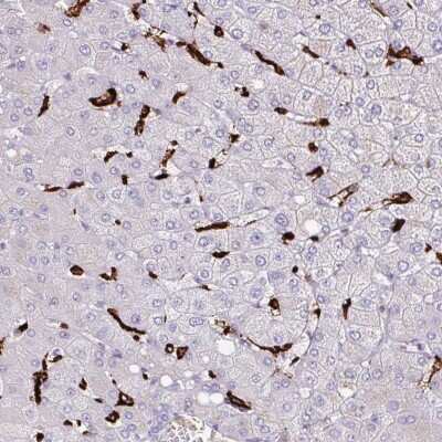 Immunohistochemistry-Paraffin: MARCO Antibody [NBP2-39004]