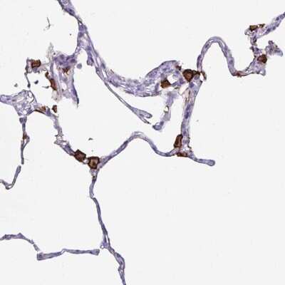 Immunohistochemistry-Paraffin: MARCO Antibody [NBP2-39004]