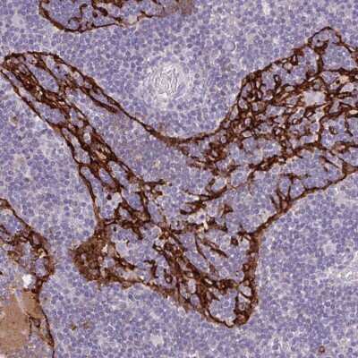 Immunohistochemistry-Paraffin: MARCO Antibody [NBP2-39004]