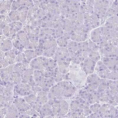 Immunohistochemistry-Paraffin: MARCO Antibody [NBP2-39004]