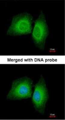 Immunocytochemistry/ Immunofluorescence: MARK1 Antibody [NBP1-33409]