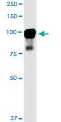 Western Blot: MARK2 Antibody (3B12) [H00002011-M01]