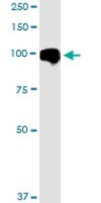 Western Blot: MARK2 Antibody (3B12) [H00002011-M01]