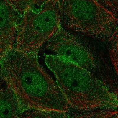 Immunocytochemistry/ Immunofluorescence: MARK2 Antibody [NBP2-57851]