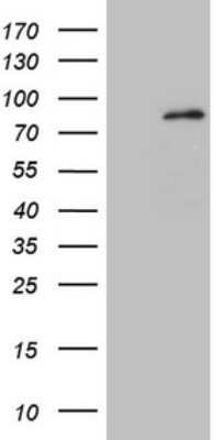Western Blot: MARK4 Antibody (OTI9B7)Azide and BSA Free [NBP2-72591]