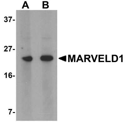 Western Blot: MARVELD1 AntibodyBSA Free [NBP1-76243]