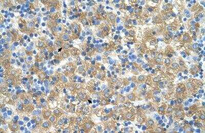 Immunohistochemistry-Paraffin: MARVELD3 Antibody [NBP1-59494]