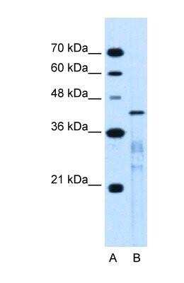Western Blot: MARVELD3 Antibody [NBP1-59494]